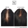 HairmaxLaserBand 82 ComfortFlex Hair Growth Device
