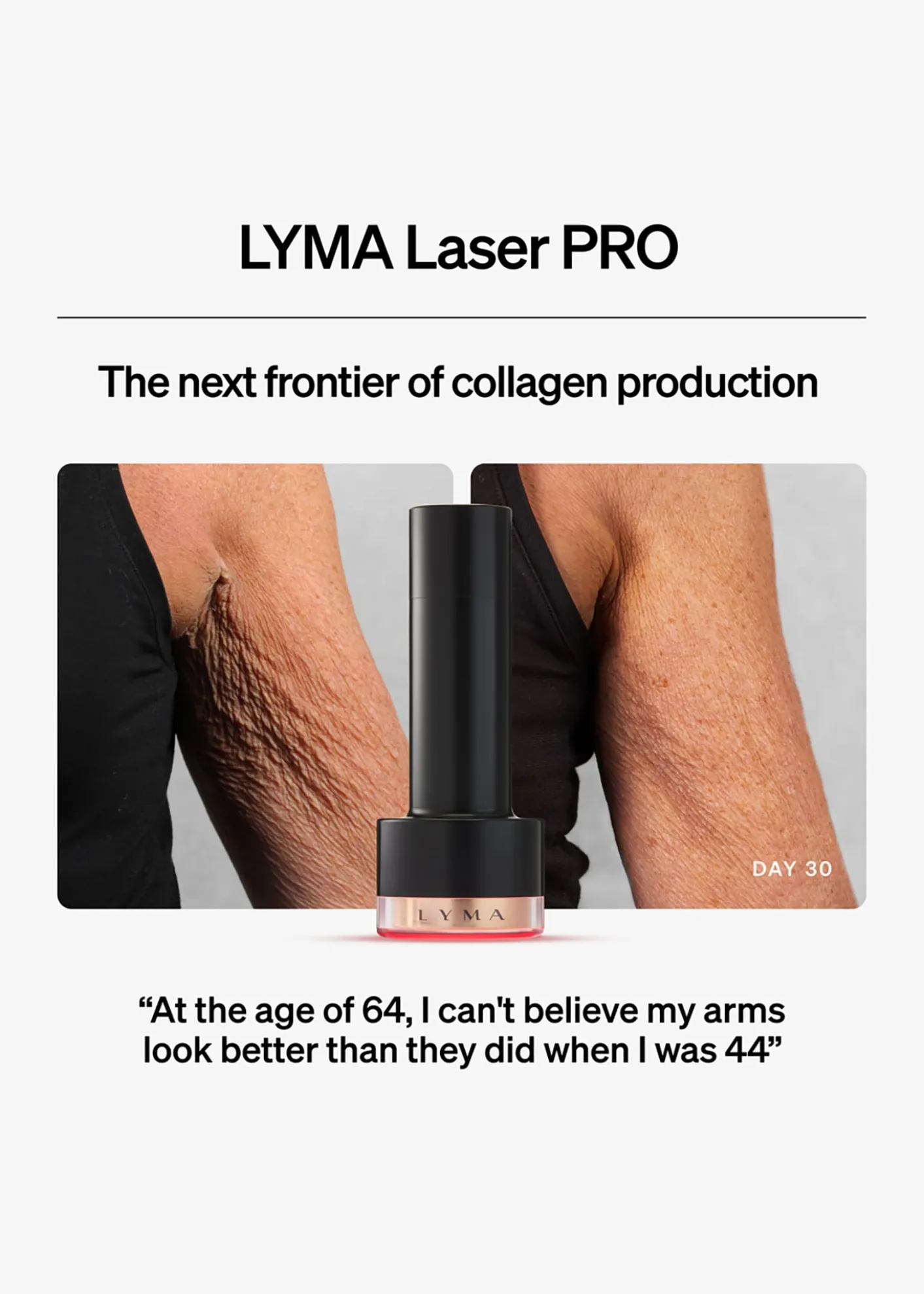 LYMALyma Laser PRO Starter Kit