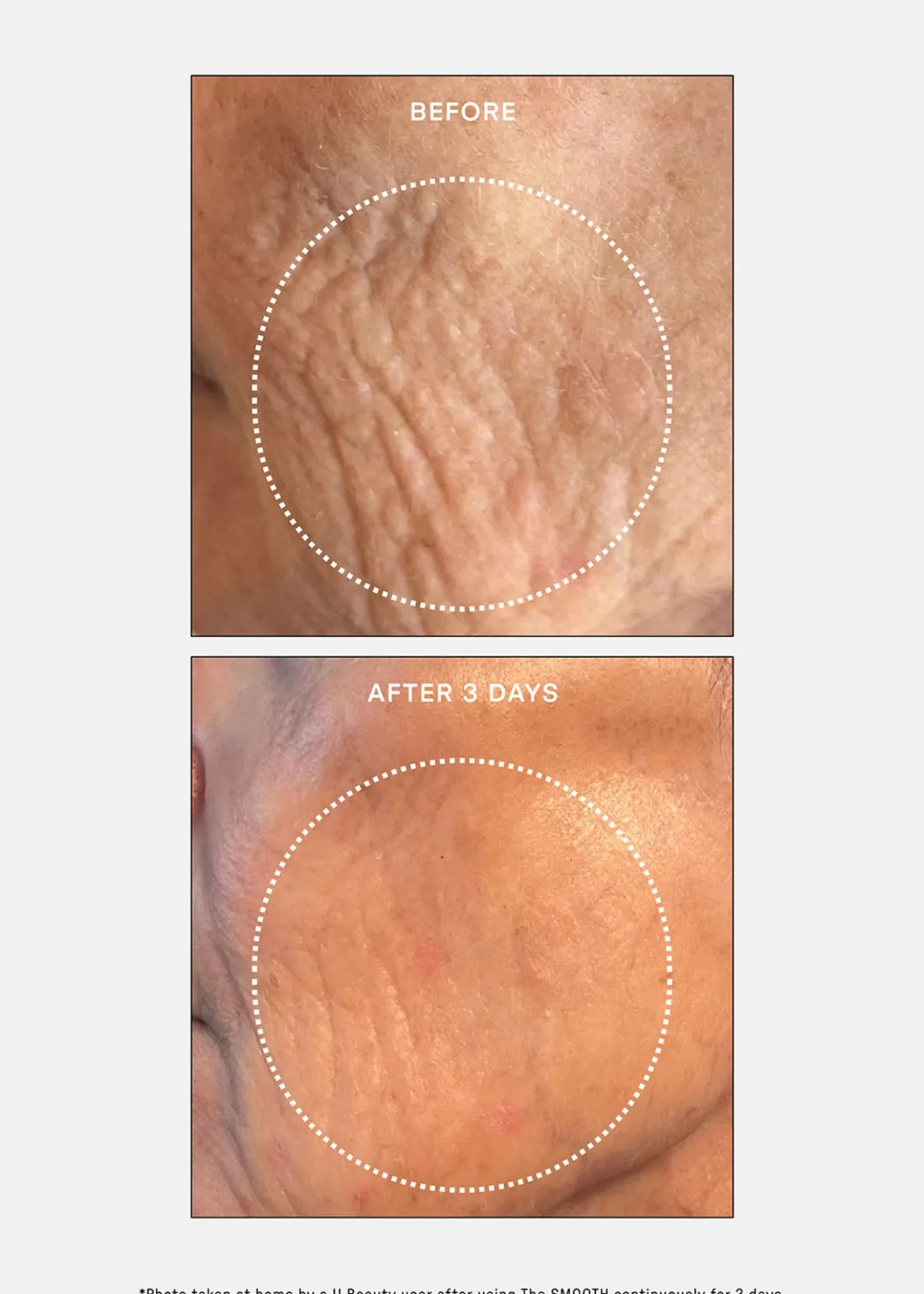 U BeautyThe SMOOTH Dynamic Wrinkle Defense Serum, 1 oz.